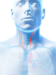 Your carotid arteries are two large blood vessels in your neck. What Is The Best Procedure To Prevent Stroke