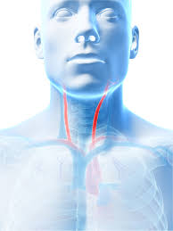 The right and left subclavian arteries give rise to the thyrocervical trunk. What Is The Best Procedure To Prevent Stroke