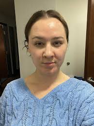 burner skincare regimen recommendations