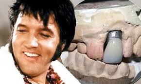 Elvis' tooth sold at auction with hair and gold record