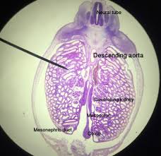 Maybe you would like to learn more about one of these? Excretory System Development Creative Diagnostics