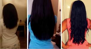 With some conditions, such as patchy hair loss (alopecia areata), hair may regrow without treatment within a year. 7 Home Remedies For Hair Growth And Thickness Stop Hair Loss Fast Newstrack English 1