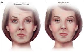 Towards the end of war, face paint was. Study Shows Stomach And Side Sleeping Positions Cause Facial Distortion And Wrinkles Over Time