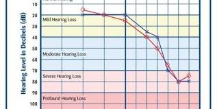 Image result for Audiogram