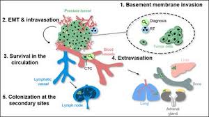 The cancer growing in the prostate may cause urinary difficulties such as needing to go frequently, poor flow, bleeding or discomfort. Frontiers Metastatic Spread In Prostate Cancer Patients Influencing Radiotherapy Response Oncology