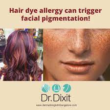 Http Www Dermatologistinbangalore Com Hair Dye Allergy Cosmetic Dermatology Dyed Hair