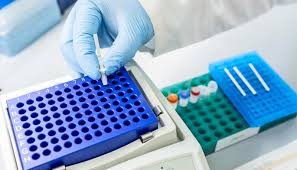 Image result for Tuberculosis Screening
