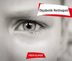 Diyabetik Retinopati Korluge Sebebiyet Verebilen Bir Durumdur Goz Kontrolunuzu Ihmal Etmeyin Bit Ly 1tyc3tx Diyabet Gozsagligi Gozler Saglik