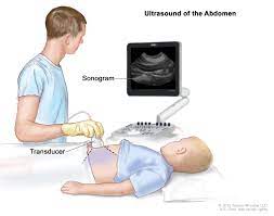 A procedure in which a blood sample is checked to measure the amounts of certain substances, such as bilirubin or lactate dehydrogenase. Childhood Liver Cancer Treatment Pdq Patient Version National Cancer Institute