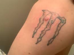 Please contact the ihd if you have additional questions. A Forbidden Pop Smallpox Vaccine Sight Popping