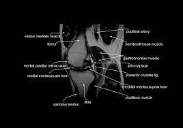 Sep 30, 2019 · if either the quadriceps or hamstring muscle groups become weak, the stability of the knee and ability to withstand an injury is decreased. Mri Knee Anatomy Knee Sagittal Anatomy Free Cross Sectional Anatomy