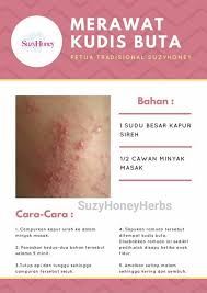 Kudis buta ataupun lebih dikenali sebagai scabies, merupakan sejenis penyakit kulityang mudah berjangkit. Sihat Cantik Seiring Suzyhoneyherbs Home Facebook