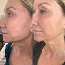 Beach Cottage Day Spa (@beachcottagedayspasb) • Instagram photos and videos