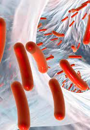Coli pathotypes, are among the most important pathogens infecting children worldwide because of their high prevalence in both the. Enteropathogenic Escherichia Coli Intechopen