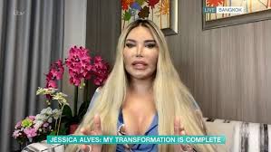 Il ken umano, rodrigo alves, si pente e rivela: Jessica Alves To Have Functioning Vagina After Gender Reassignment Op Metro News