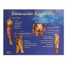 Life Form Intramuscular Injection Sites Chart