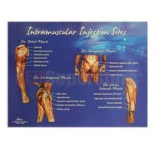 life form intramuscular injection sites chart