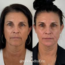 rēVive Medical Aesthetics