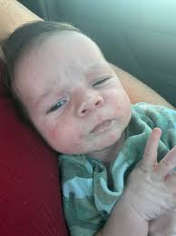 What causes skin issues