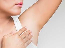 Believe it or not, that bump in your armpit might not be an ingrown hair. Ingrown Hair Armpit