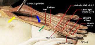 The musculature of the arm is illustrated by medical students are all gathered around the cadaver, with full focus on the professor. New Insight Into The Enigmatic White Cord In Rembrandt S The Anatomy Lesson Of Dr Nicolaes Tulp 1632 Sciencedirect