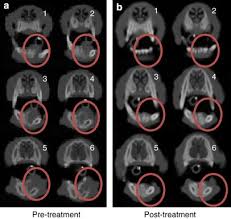 Treatment should be attempted only after a thorough discussion with your veterinarian. Bleomycin Interleukin 12 Electrochemogene Therapy For Treating Naturally Occurring Spontaneous Neoplasms In Dogs Cancer Gene Therapy