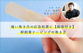 痛い巻き爪の応急処置に【動画付き】絆創膏テーピングの巻き方 | ながい接骨院