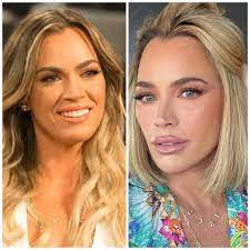 I'm not a fan of teddi but she was so naturally beautiful , she didn't need  all this procedures and plastic surgery : r/BravoRealHousewives