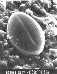 It comes in dust formulas, and can be applied anywhere pests frequent. Diatomaceous Earth For Controlling Pests Survival Mom