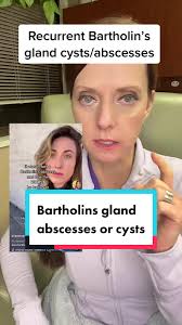 Did you have a bartholins gland abscess or cyst?! #gyn #gynecology  #bartholinabscess #bartholincyst #gynecologist #gyntok
