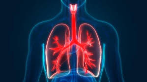 In this section we explain how asbestos can cause lung cancer or mesothelioma. What Type Of Cancer Is Mesothelioma Lung Cancer Lawsuit Lawyers Pintas Mullins Law Firm