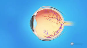 Retinal detachments occur in 1 out of 10,000 americans each year. Detached Retina American Academy Of Ophthalmology