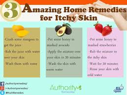Home Remedies For Itchy Skin Home Remedies Remedies Holistic Health