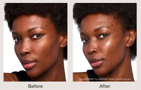 Everything To Know About SkinVive