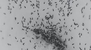Fleas who have just eaten can become twice as large as their normal size. Snow Fleas When A Flea Isn T A Flea Insect Diagnostic Lab