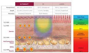 Are there any risks of having ultherapy treatment? How Does Ultherapy Work Steiger Facial Plastic Surgery Boca Raton Facelift Rhinoplasty Eyelid Surgery Laser Skin Fillers Coolsculpting