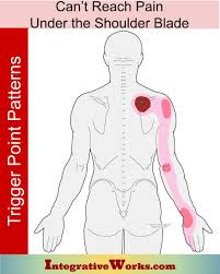 Pin On Shoulder Trigger Point Pain