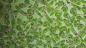 These types of protozoahave little impact on human health given that they do not directly depend otherorganisms for their survival. Euglena Protozoa In Pond Water Stock Video Clip K003 5690 Science Photo Library