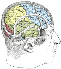 Usually, a displacement of the bisection mark towards the side of the brain lesion is. Hemispatial Neglect Wikipedia