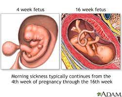 How long until morning sickness starts. Morning Sickness Lima Memorial Health System