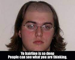 Funniest hairline roasts (jokes) for people with receding hairlines. Funny Hairline Jokes Roasts Hairline Jokes Funny Hairlines Jokes