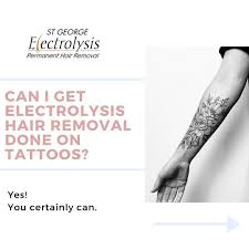 Laser hair removal has been very popular, and only sydney has 20+ clinics. St George Electrolysis Clinic å¸–å­ Facebook