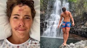 Caleb Coffee Talks to Fans After 80-Foot Fall Off Cliff