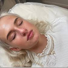 Paula brookes- Timeless Aesthetics ®️ (@paula_timelessaesthetics) · Rugby