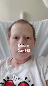 Living with Stage 4 Breast Cancer: A Day in the Life of Eribulin Day 144