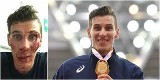 Jun 27, 2021 · champion du monde du 800m en 2017, pierre ambroise bosse est encore loin d'avoir une place assurée aux jeux olympiques de tokyo. L Agresseur Presume De Pierre Ambroise Bosse Se Retourne Contre L Athlete Dh Les Sports