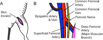 Anatomy of the thigh and leg the thigh is best described in terms of compartmental anatomy, and upper leg. Schematic Illustrations Of Skin Incision And Vasculature Anatomy A Download Scientific Diagram