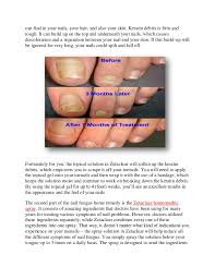 We did not find results for: How To Get Rid Of Nail Fungus