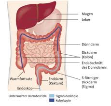 Alles Was Sie Uber Eine Magen Und Darmspiegelung Wissen Mussen