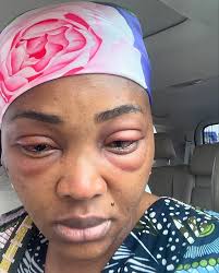 I woke up one morning